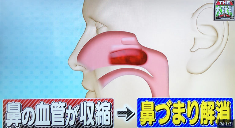 鼻づまりとは何なのか、またそれがより深刻な兆候である場合を調べてください。