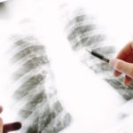 自律神経はどこにあるのか?場所と役割、バランスがくずれる原因とは